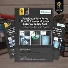 Pencitraan Foto Polos Sinar X Torakoabdominal Kelainan Bedah Anak : Pemahaman Ilmu Dasar untuk Diagnosis