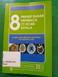 8 Prinsip Dasar Membaca CT-Scan Kepala